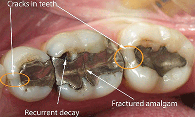 Dental Photography