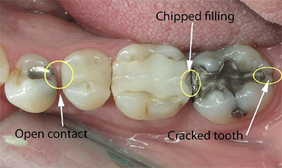 Dental Photography