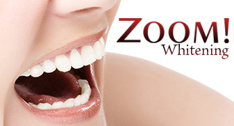 Las Vegas Teeth Whitening Services